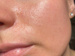 Does Oily Skin Age Better