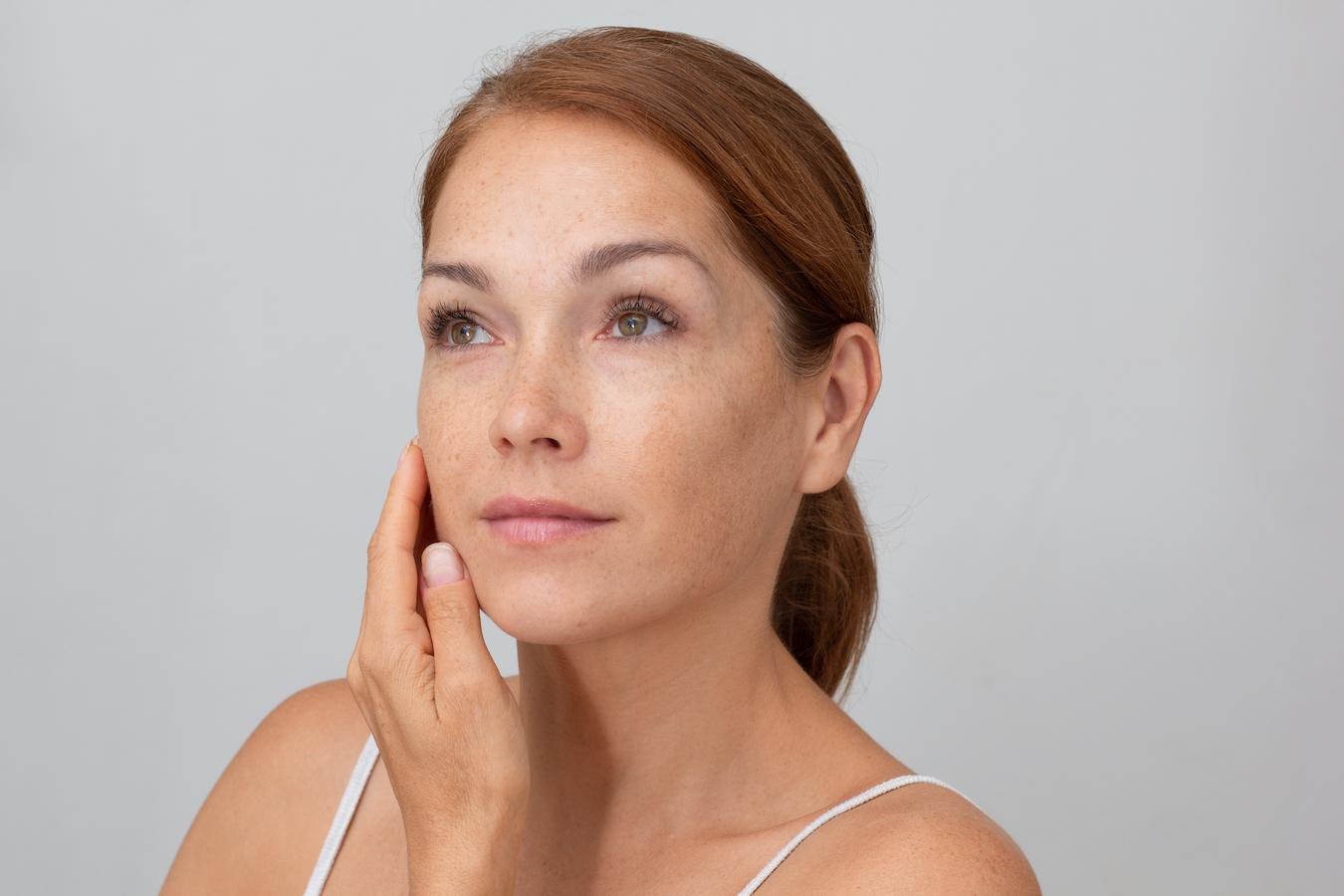 How To Get Rid Of Age Spots