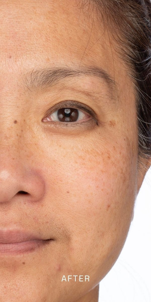 After using Radiance Enzyme Scrub, 2.5 oz