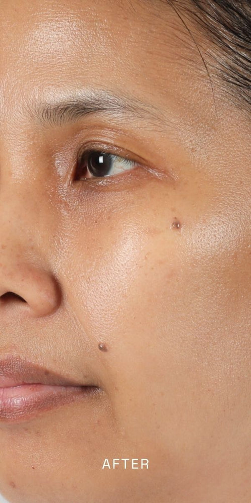 After using Radiance Vitality Oil, 1 oz - Radiant Skin Care