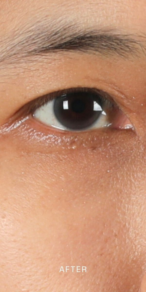 After using Miracle Tea Complete Eye Creme, 0.5 oz