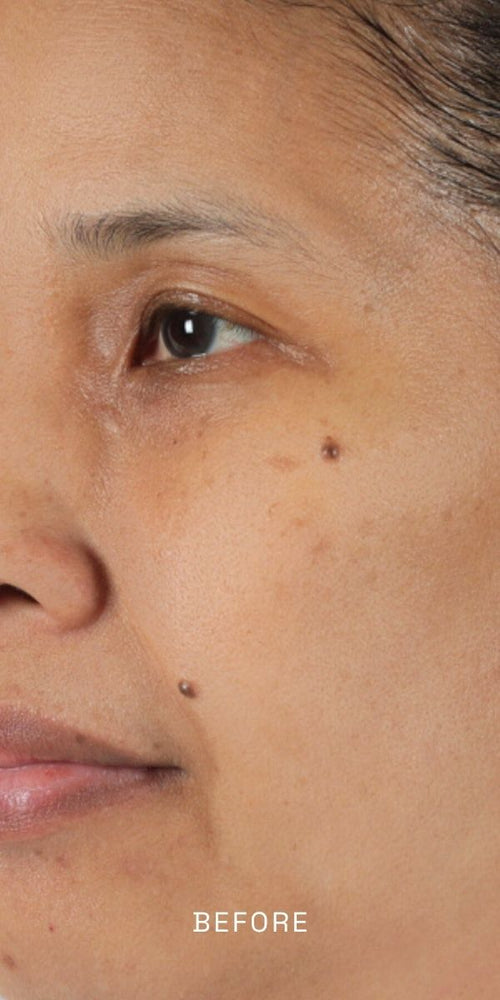 Before using Radiance Vitality Oil, 1 oz - Radiant Skin Care