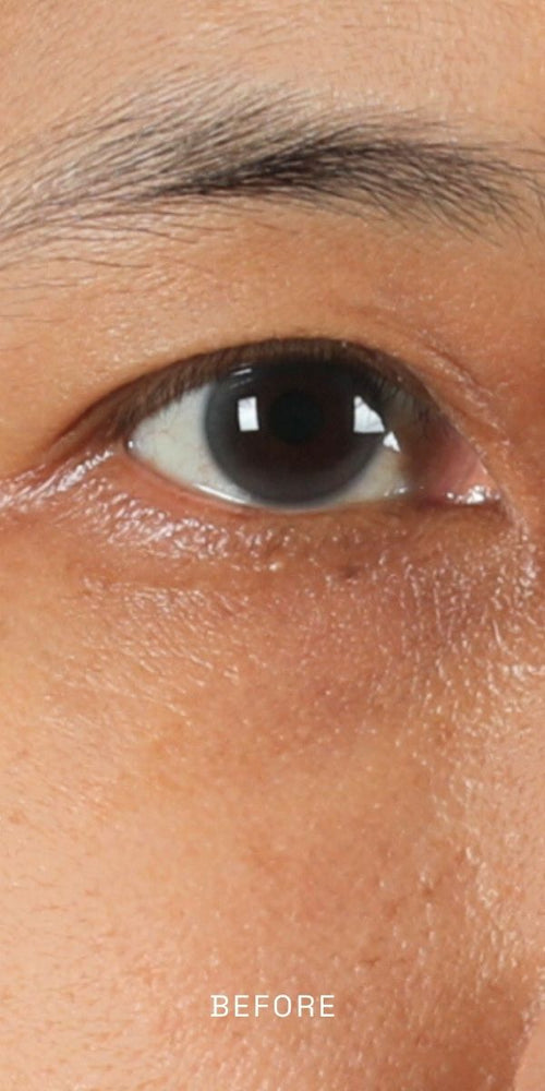 Before using Miracle Tea Complete Eye Creme, 0.5 oz