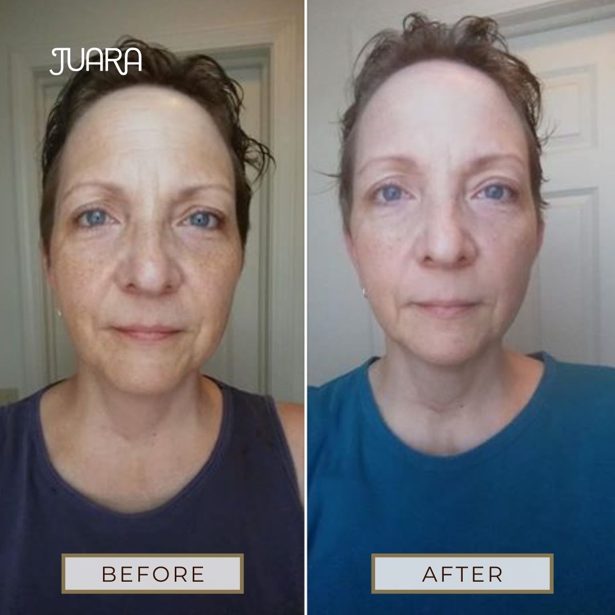The JUARA Face Ritual for Normal To Dry Skin